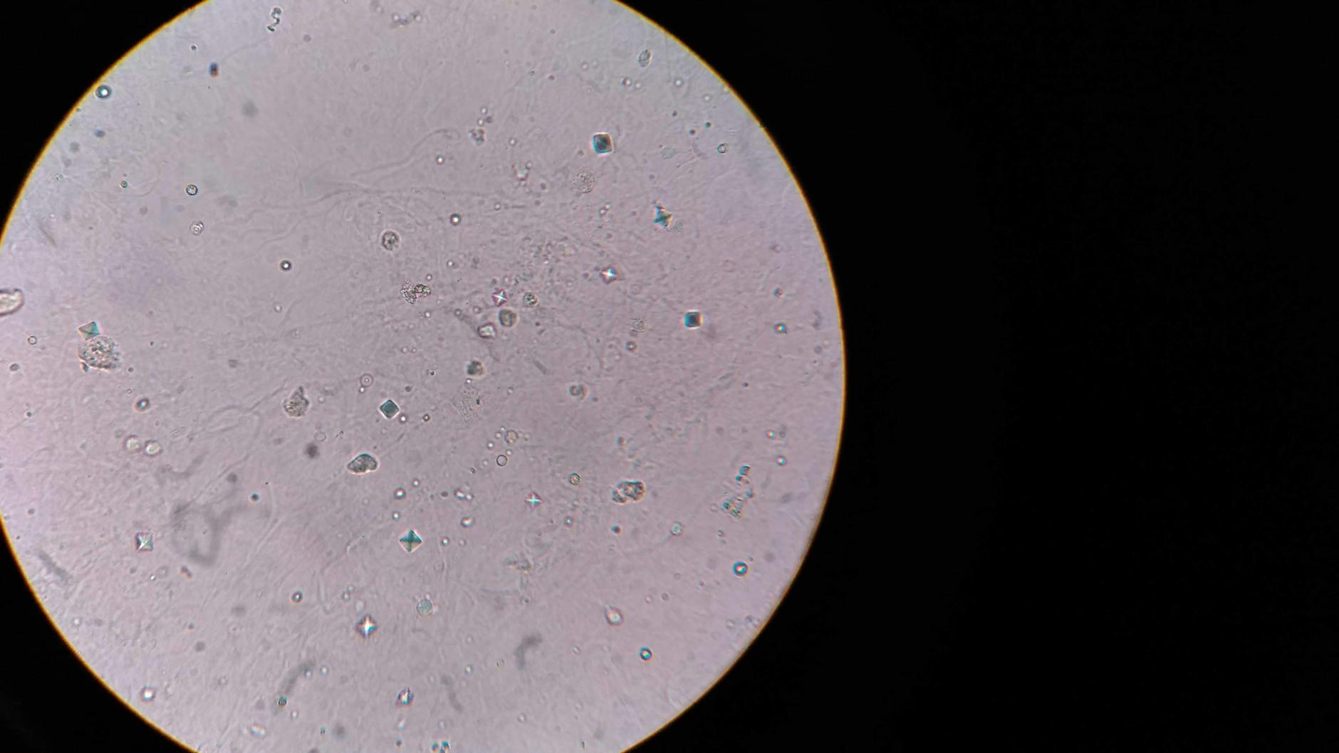 Cells: The Bacterium You Can See Without a Microscope
