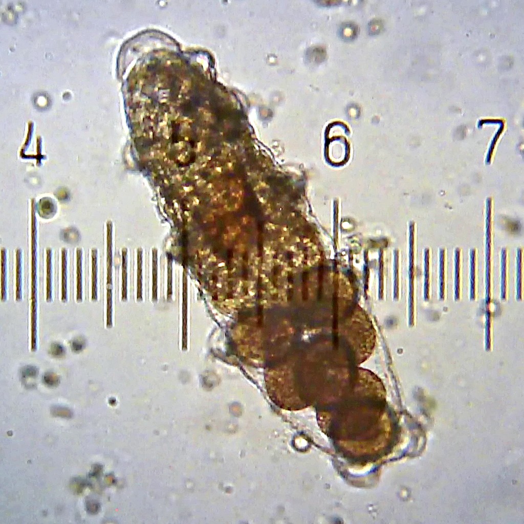 Tardigrade Love: Molts, Stabs, and Spiky Eggs